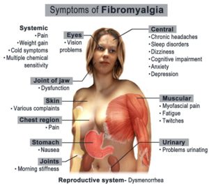 symptoms of fibromyalgia