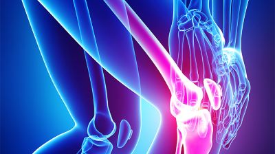 living with osteoarthritis, Degenerative Joint Disease