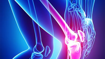 Degenerative Joint Disease