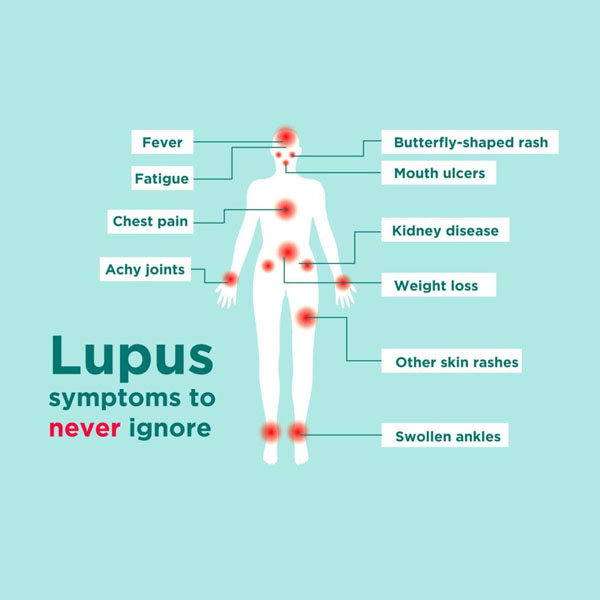 Learning About Lupus