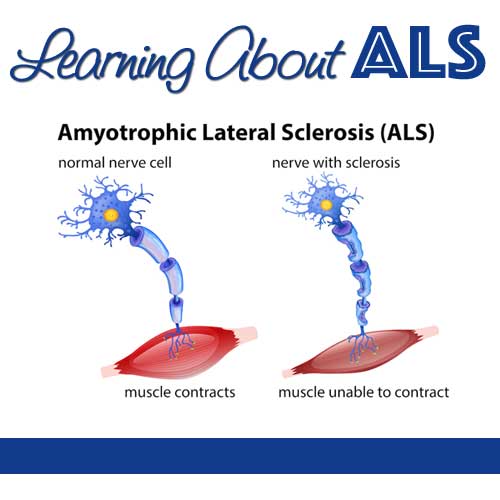 Learning About Amyotrophic Lateral Sclerosis (ALS) aka Lou Gehrig’s Disease