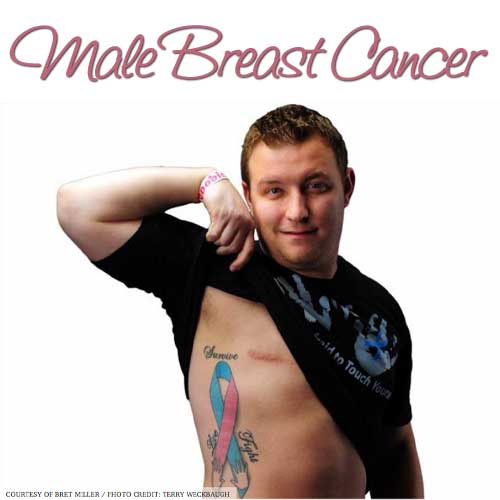 Men Get Breast Cancer Too