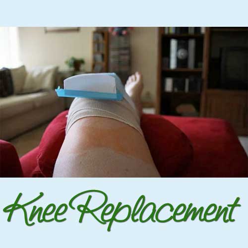 Knee Replacement Surgery